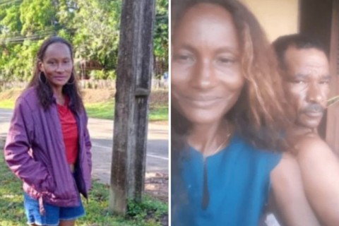 Morre mulher que teve 90% docorpo queimado pelo marido